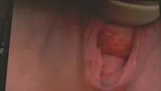 চালান ব্লক বোতাম detrition এবং জোর আউট